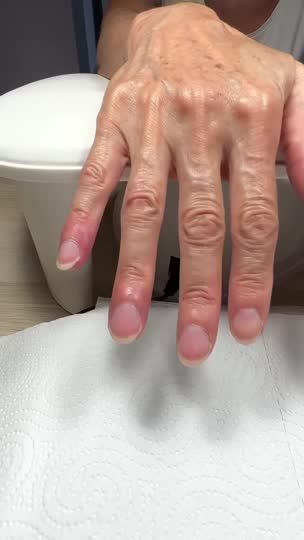 Antes y después de un tratamiento en VS Nails & Beauty