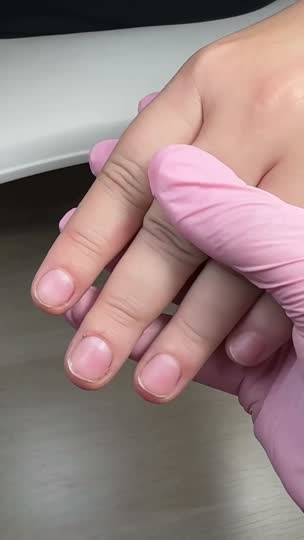 Antes y después de un tratamiento en VS Nails & Beauty